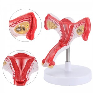 Model anatomi uterus wanita kanthi ovarium