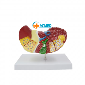 Medical science experiment liver anatomy model with base doctor-patient communication model, human physical model