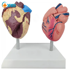 ადამიანის ანატომიის გულის მოდელი 2ნაწილიანი PVC სწავლების მოდელები გულის ჯანმრთელობა და ავადმყოფი შეადარეთ გულის მოდელი