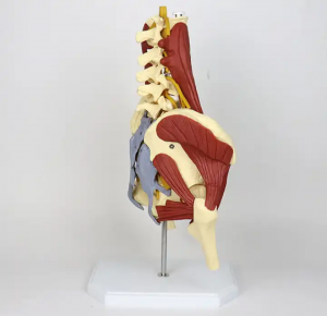 medicinsk videnskab Suspenderet menneskekrop fem-sektion lændehvirvel med nerve intervertebral diskusprolaps med muskelmodel