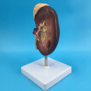 Venda directa de fàbrica de subministrament directe model anatòmic de ronyó model d'educació d'òrgans mèdics model de ronyó de plàstic humà 2X gran